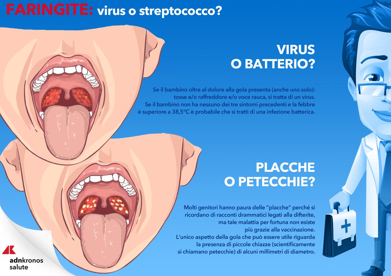 Mal di gola virus o streptococco