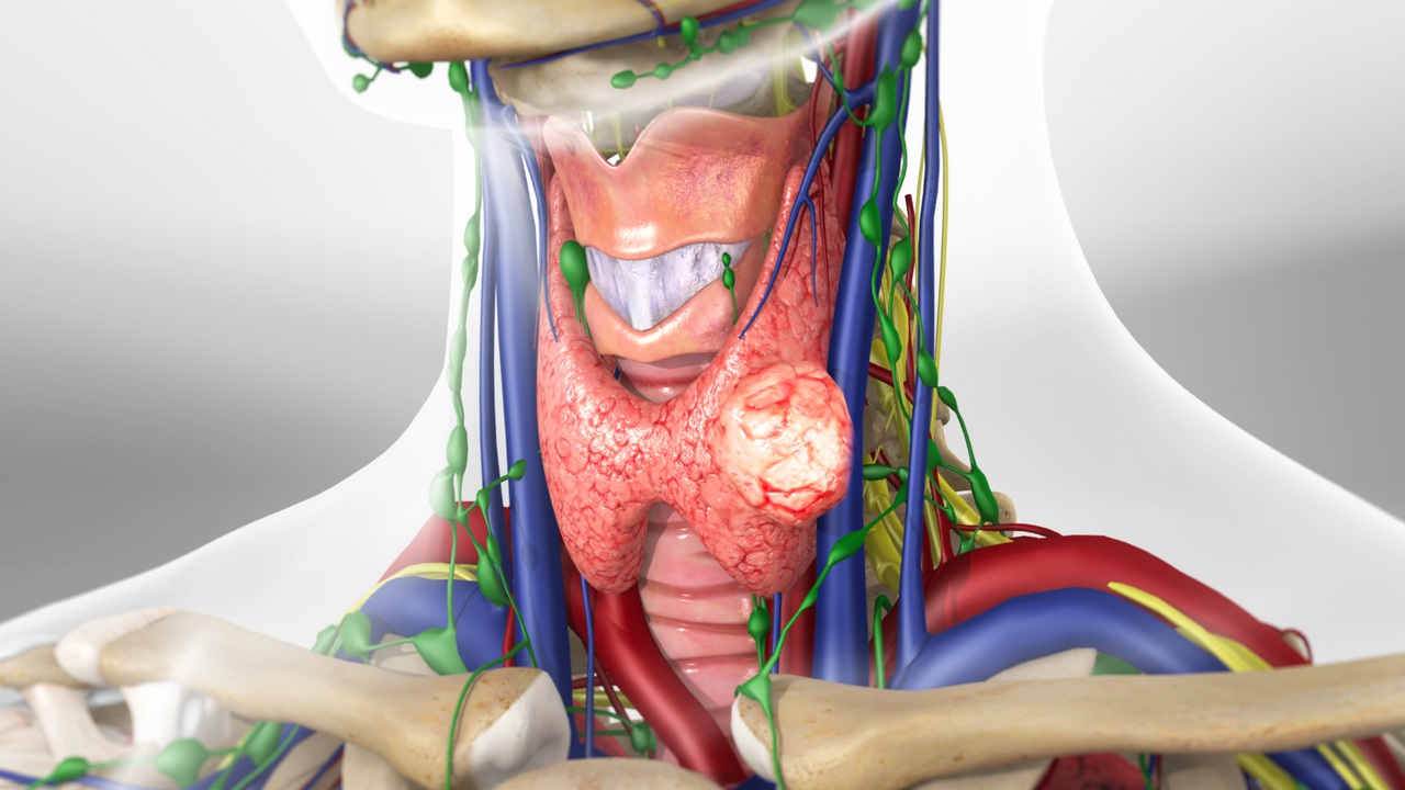 thyroidnodule_1280