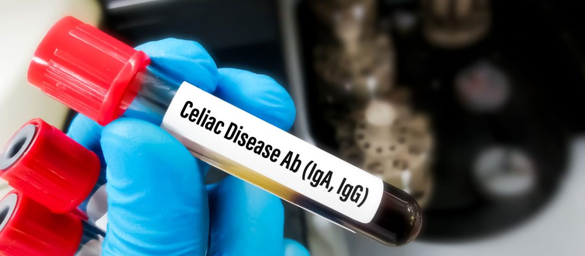 Fig.3-Diagnosi-Celiachia-senza-Biopsia---WEB