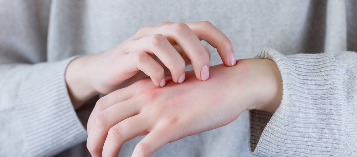 Il prurito come segno di malattia