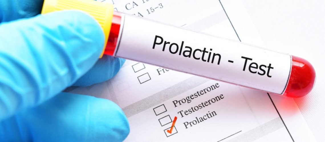 Blood sample tube with laboratory requisition form for prolactin hormone test