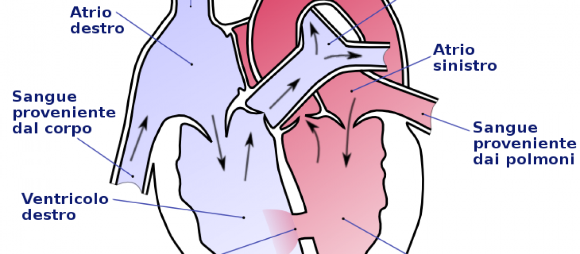 Ventricular_septal_defect-it