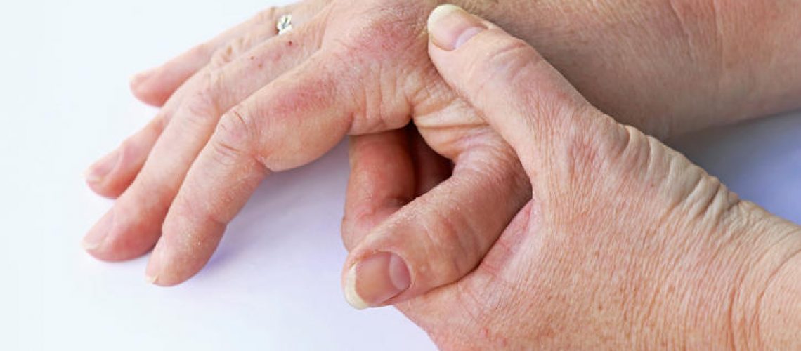 artrite-psoriasica