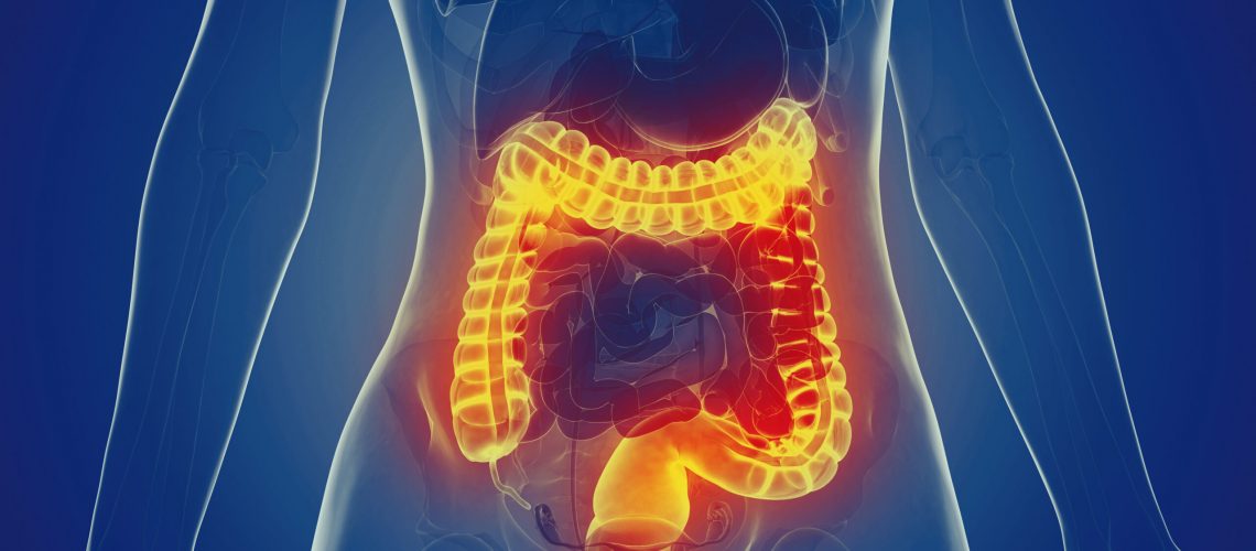 Le comorbilità nella malattia diverticolare