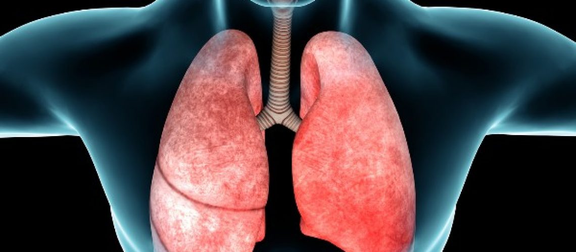 fibrosi-polmonare-1