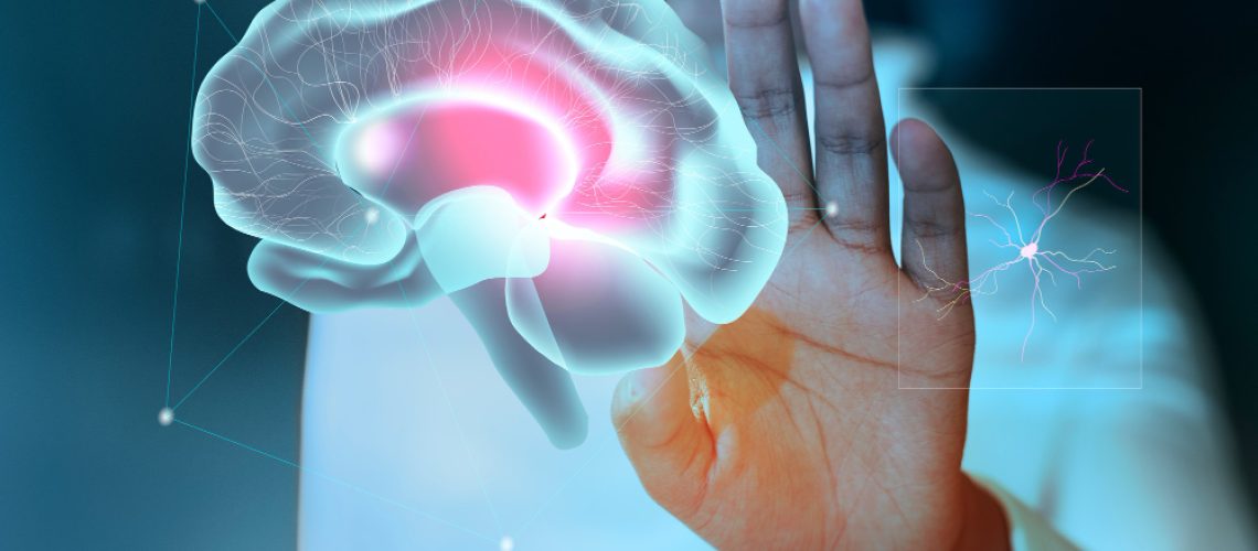 ictus-stress-2026-000