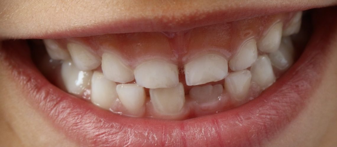 lesione-denti