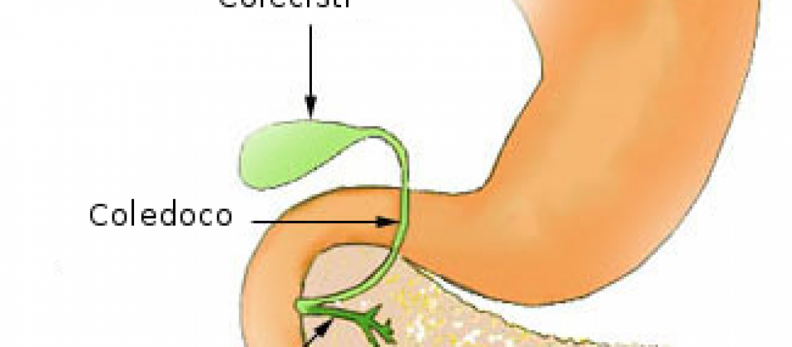 pancreatite