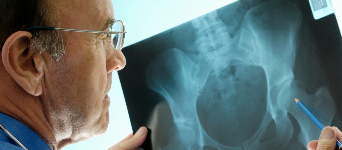 step-1_fonte-Starbene