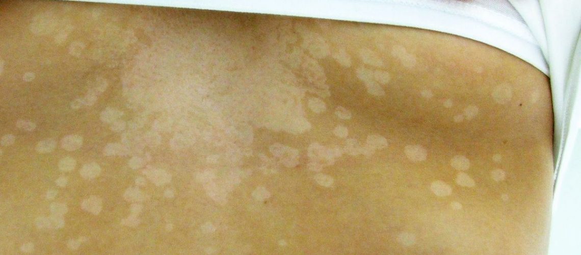 step-_fonte-Wikipedia